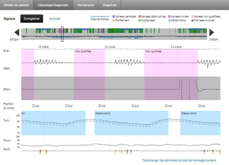 apnealink-air™-diagnostic-rapport-resmed