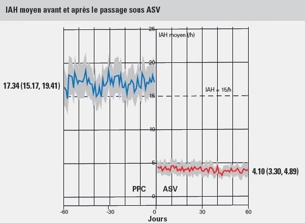 IAH moyen avant et apres le passage sous ASV