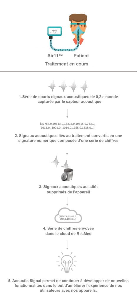 Schéma montrant comment le capteur acoustique des appareils ResMed Air11 peut capturer des signaux sonores qui sont envoyés pour évaluation via le cloud.