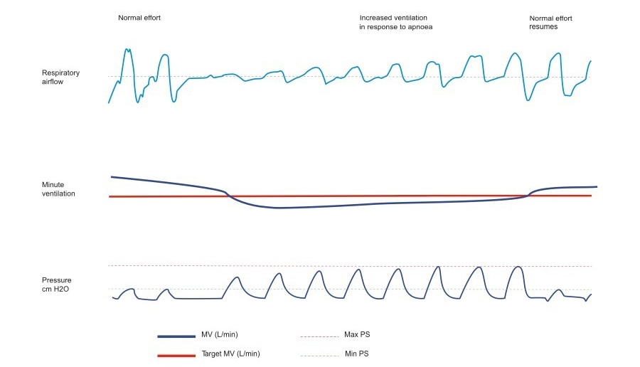 graphique de l'algorithme pacewave