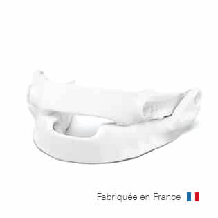 narval-cc-oral-appliance-left-view-resmed