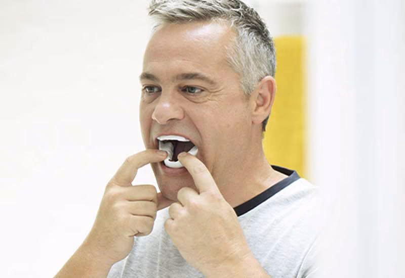  Orthèse d’Avancée Mandibulaire