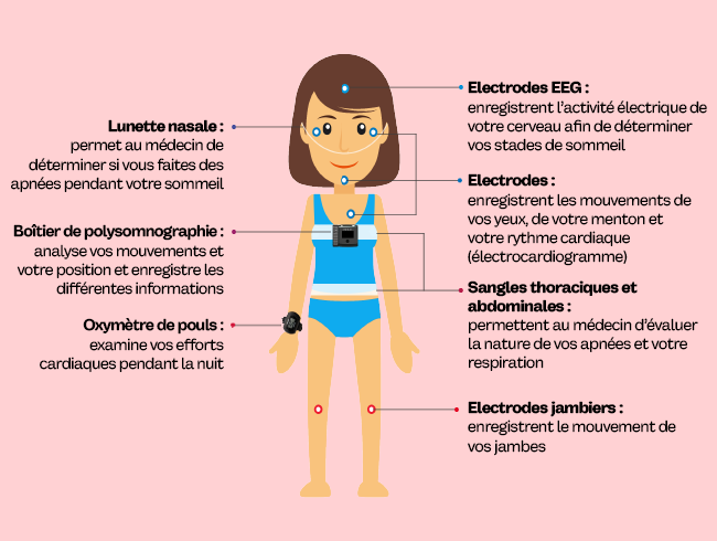  schema-equipement-polysmonographie-a-l-hopital